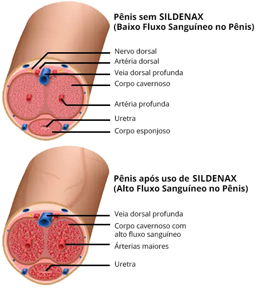 Sildenax Funciona