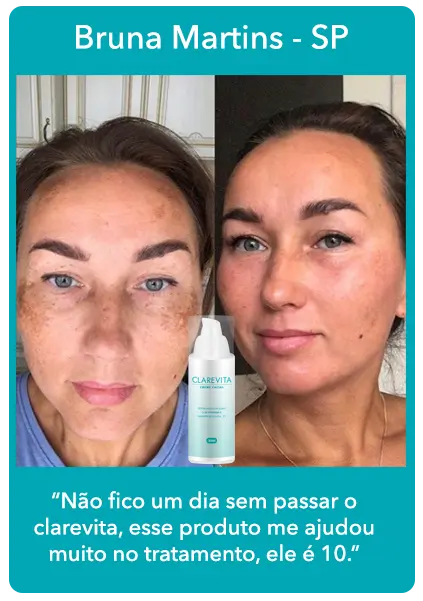 Clarevita antes e depois