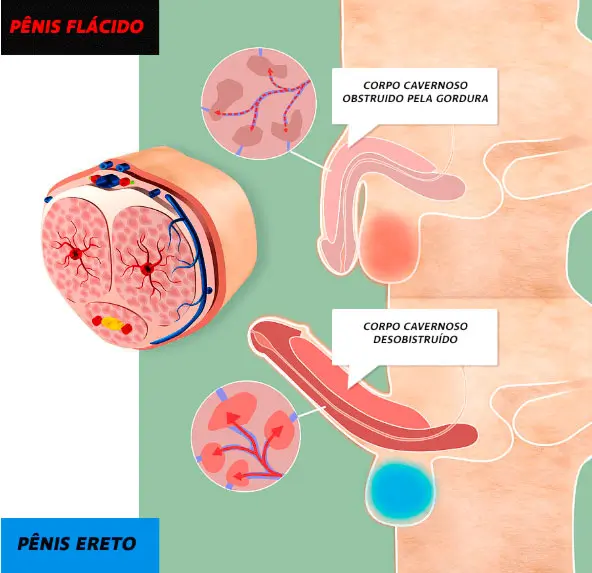 Como funciona o max size gel