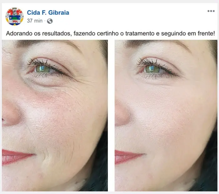 HerBeauty Depoimento