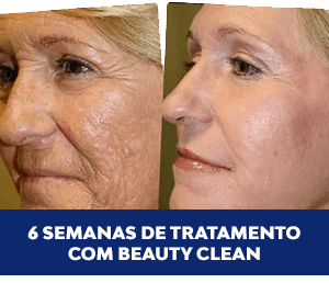 Beauty Clean antes-e-depois-1