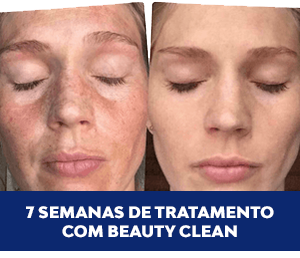 Beauty Clean antes-e-depois