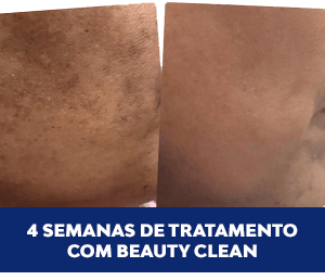 Beauty Clean antes-e-depois