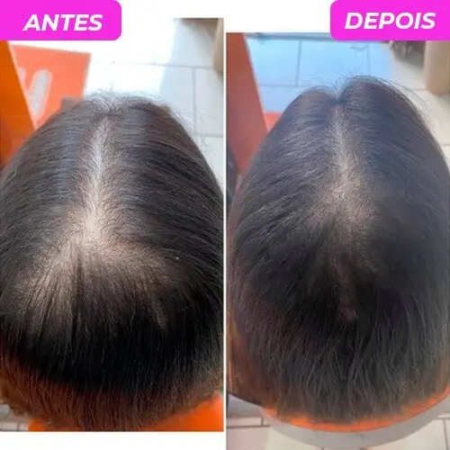 happy hair antes e depois