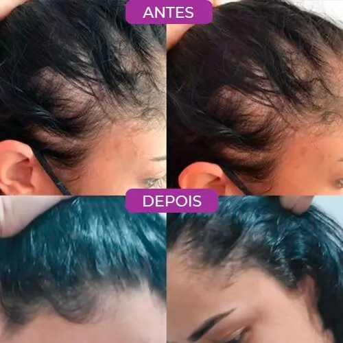 happy hair antes e depois