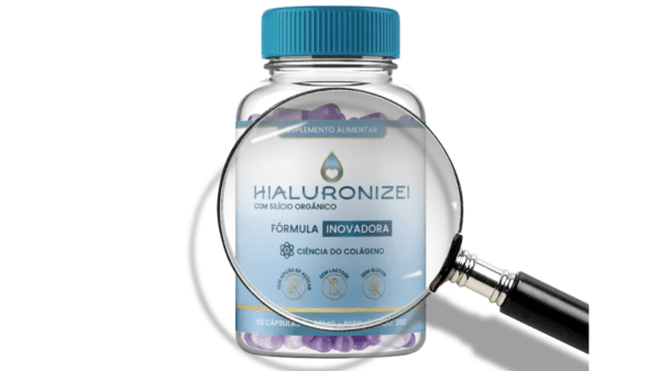 hialuronizei